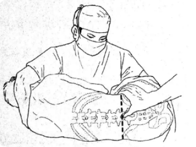 Anesthesia Puncture Procedure Pack: The One-Stop "Painless Switch" – How Much Do You Know About It?